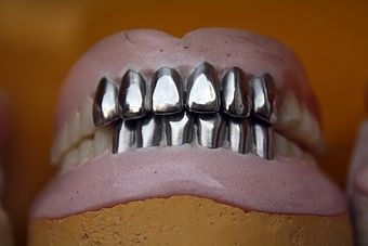 prótese dentária 