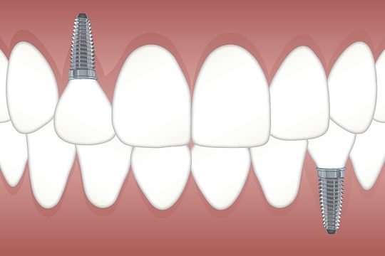 teeth-3597679_150.jpg